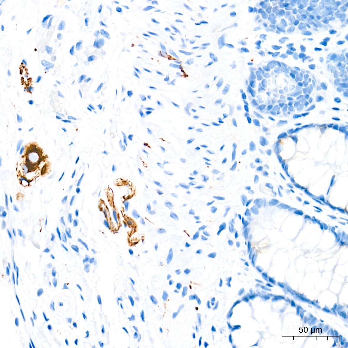 Neurofilament L Rabbit mAb