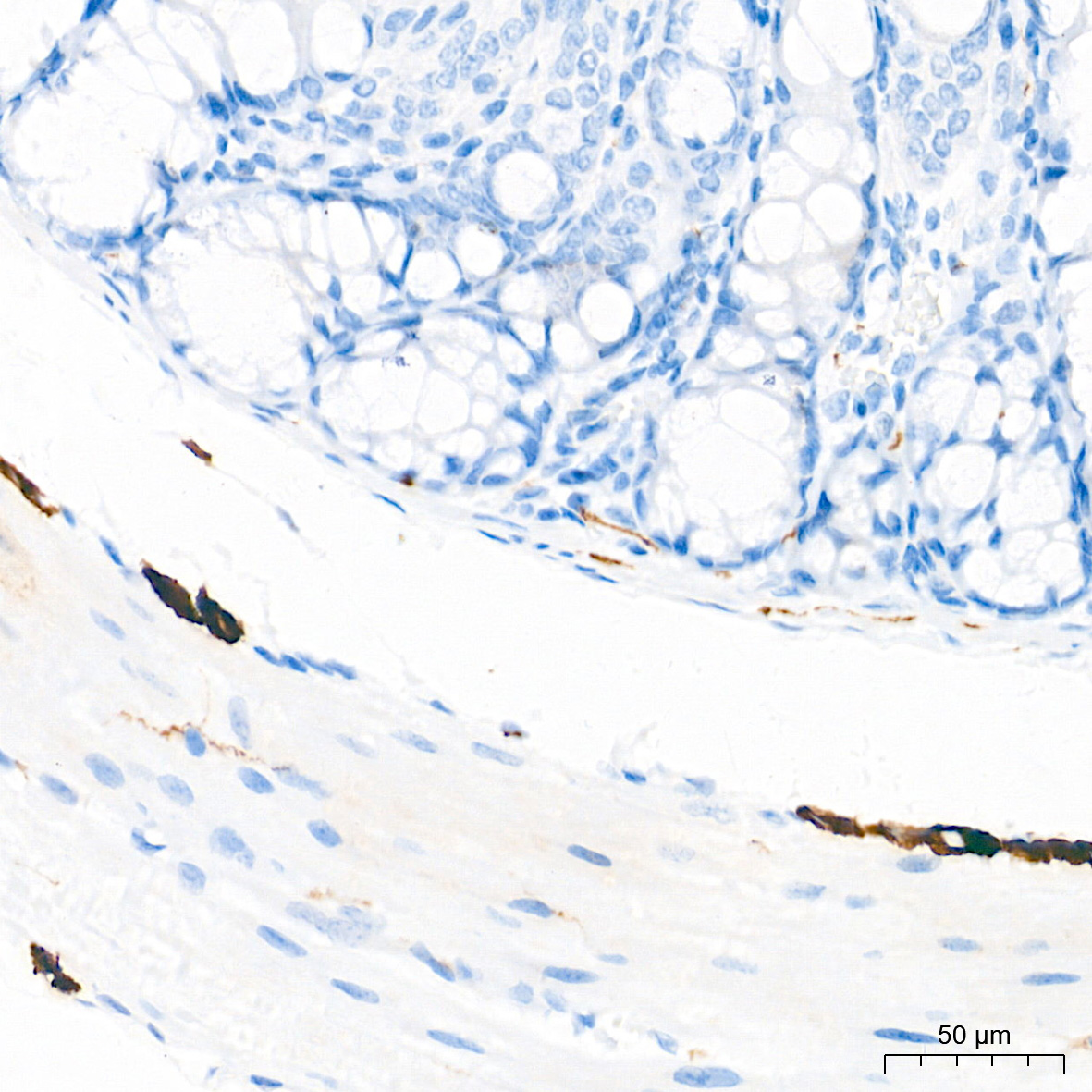 Neurofilament L Rabbit mAb