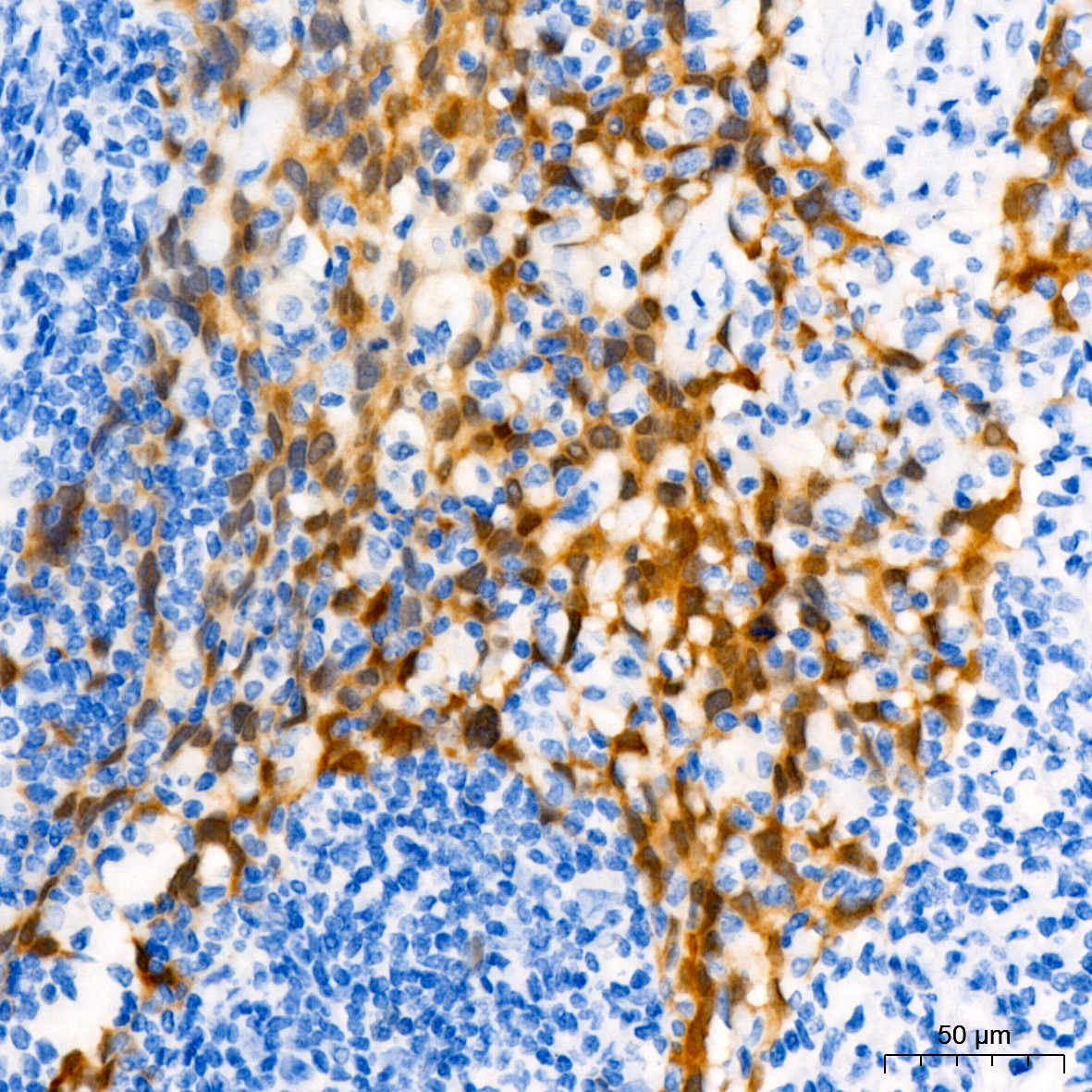 CDKN2A/p16INK4a Mouse mAb