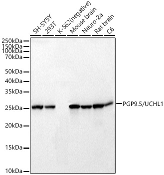 PGP9.5/UCHL1 Rabbit mAb