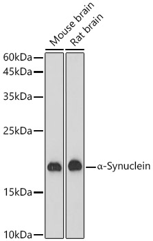 α-Synuclein Rabbit mAb