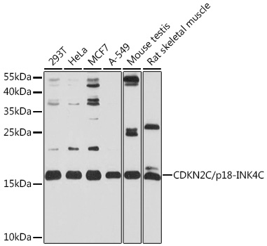 CDKN2C/p18-INK4C Rabbit pAb