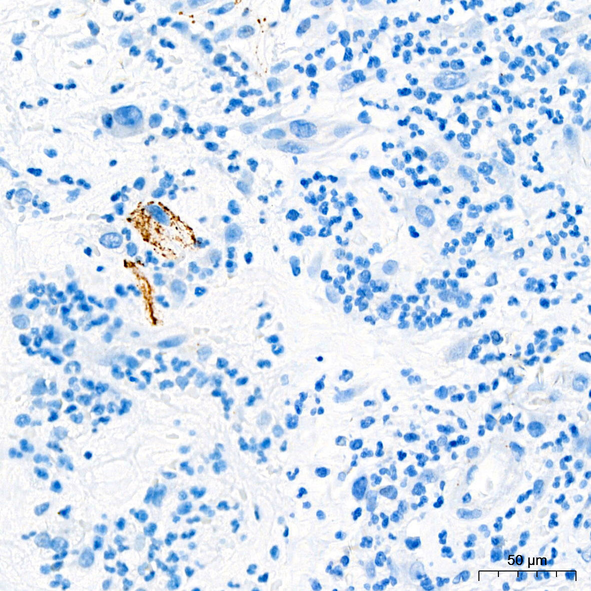 Somatostatin (SST) Rabbit mAb