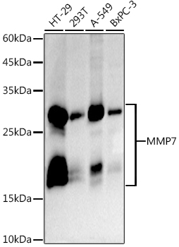 MMP7 Rabbit mAb