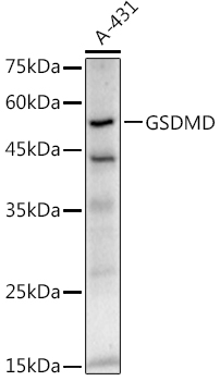 GSDMD (Full length+C terminal) Rabbit mAb