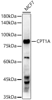 CPT1A Rabbit mAb