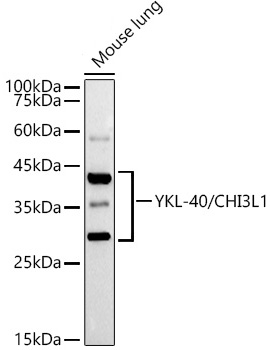 YKL-40/CHI3L1 Rabbit mAb