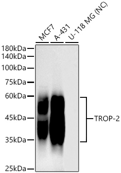 TROP-2 Rabbit mAb