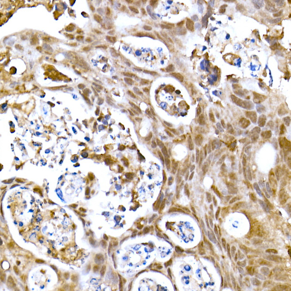 SOCS1 Rabbit mAb