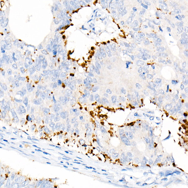 Perilipin-2 Rabbit mAb