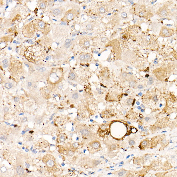 Perilipin-2 Rabbit mAb