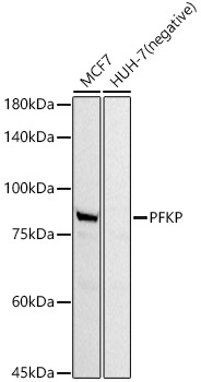 PFKP Rabbit mAb