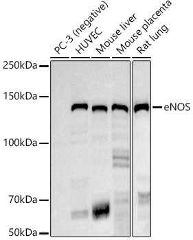 eNOS Rabbit mAb