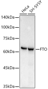 [KO Validated] FTO Rabbit mAb