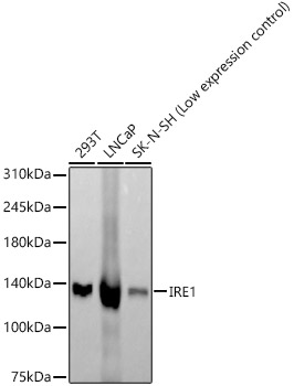 IRE1 Rabbit mAb