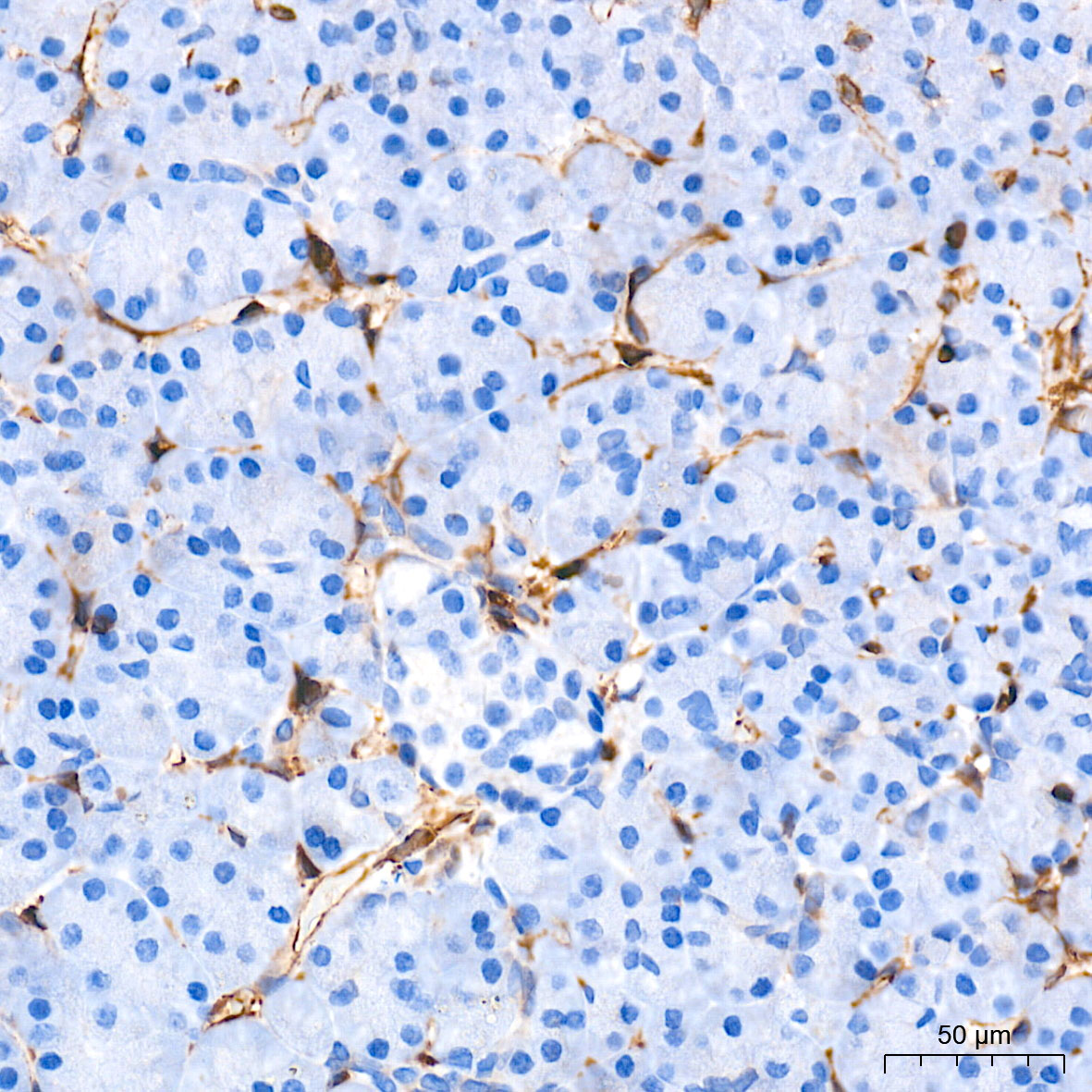 STING/TMEM173 Rabbit mAb
