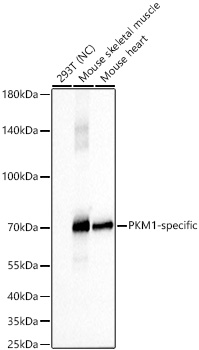 PKM1-specific Rabbit mAb