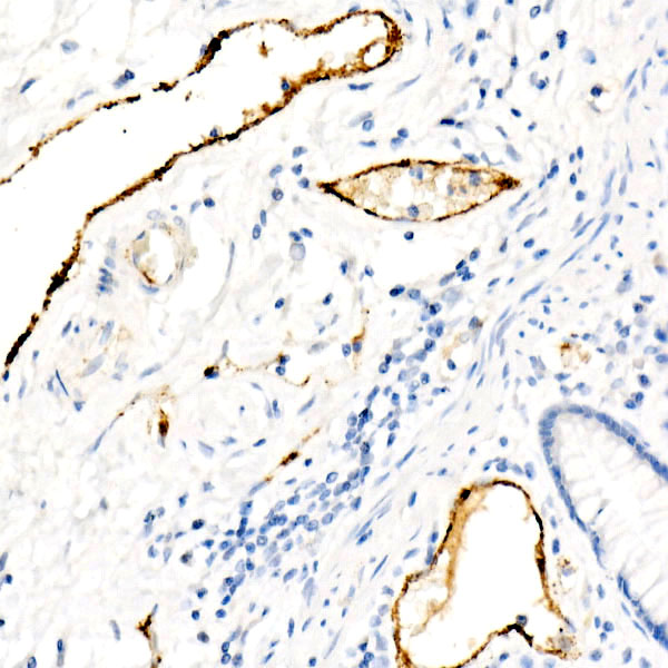 von Willebrand factor (VWF) Rabbit mAb