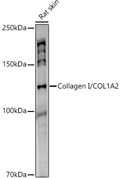 Collagen I/COL1A2 Rabbit mAb