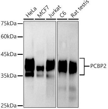 hnRNP E2/PCBP2 Rabbit mAb