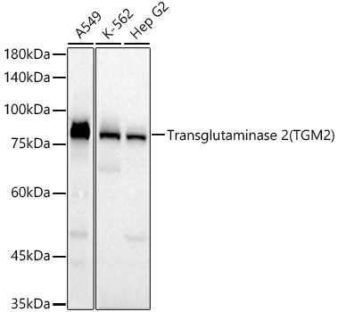 Transglutaminase 2 (TGM2) Rabbit mAb