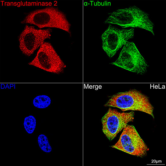 Transglutaminase 2 (TGM2) Rabbit mAb