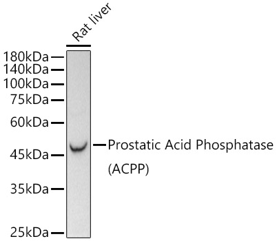 Prostatic Acid Phosphatase (PSAP)  Rabbit mAb