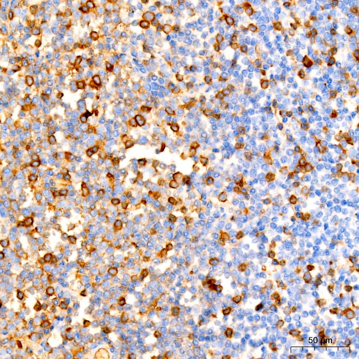 human IgG (Fc) Mouse mAb