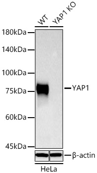 [KO Validated] YAP1 Rabbit mAb