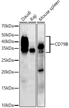 CD79B Rabbit mAb