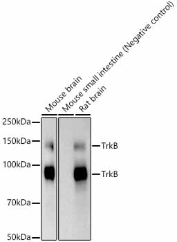 TrkB Rabbit mAb