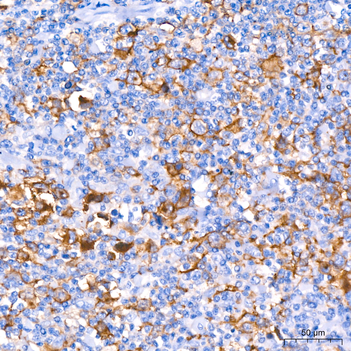 CD30 Rabbit mAb