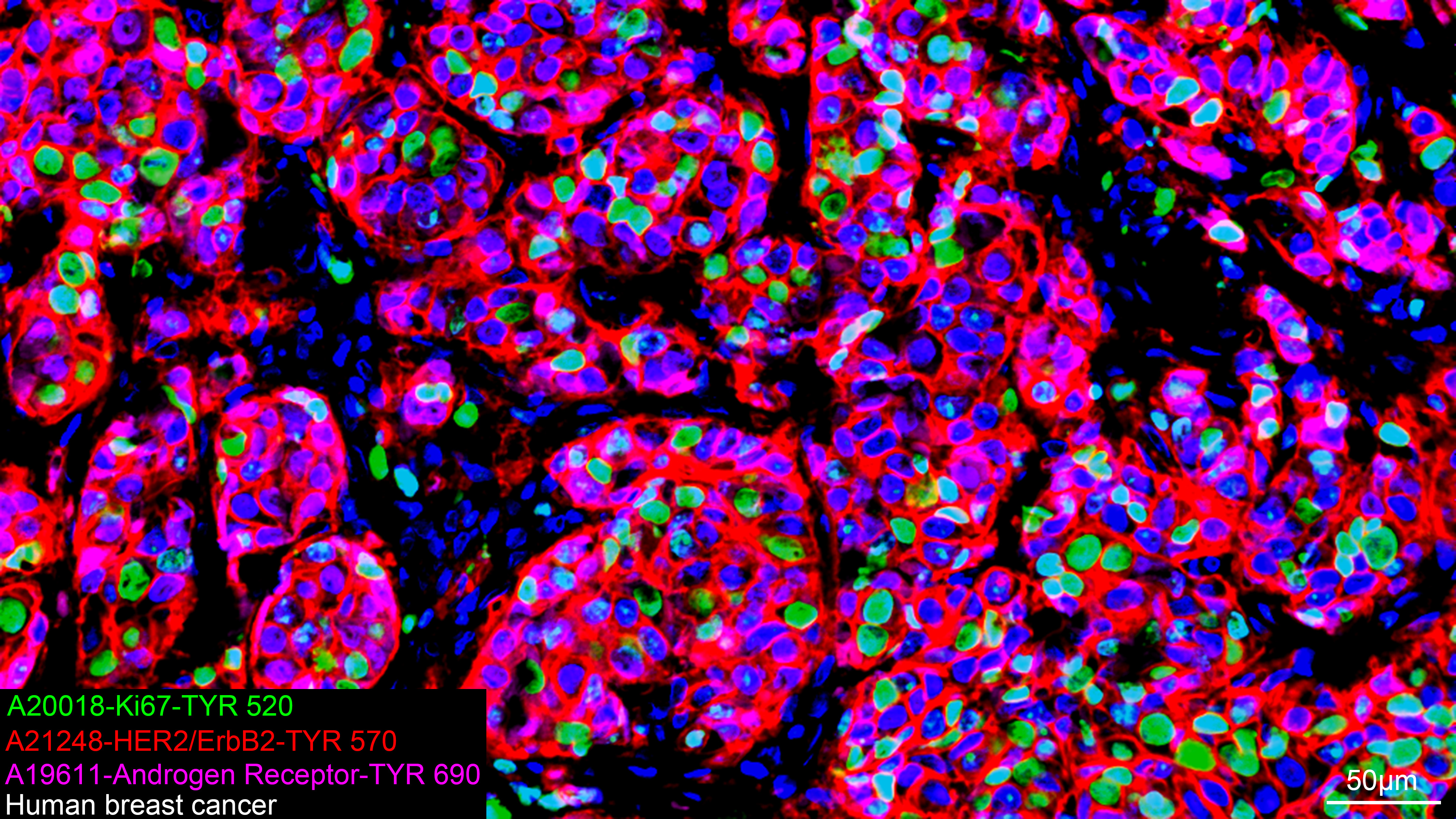 HER2/ErbB2 Rabbit mAb