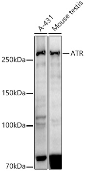 ATR Rabbit mAb