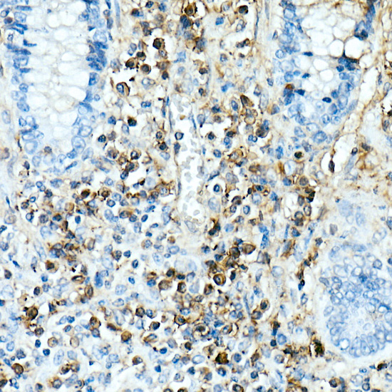 IL17A Rabbit mAb