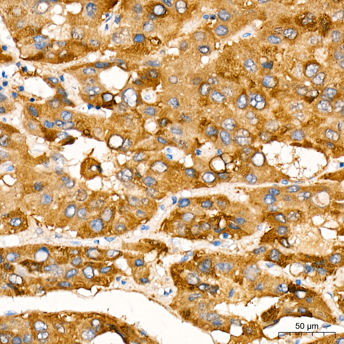 Mitofusin-1/MFN1 Rabbit mAb