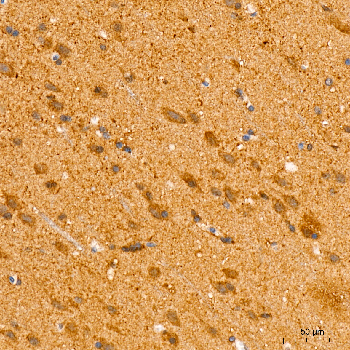 Mitofusin-1/MFN1 Rabbit mAb
