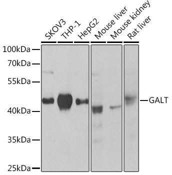 GALT Rabbit pAb