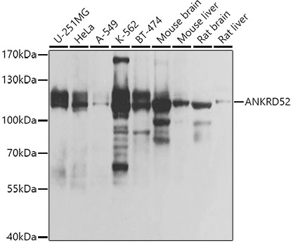 ANKRD52 Rabbit pAb