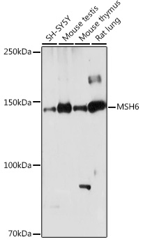 [KO Validated] MSH6 Rabbit pAb