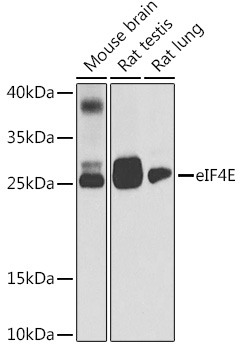 [KD Validated] eIF4E Rabbit pAb