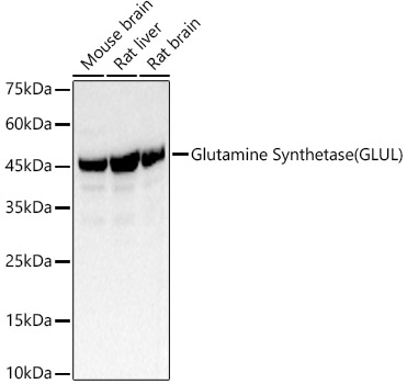 Glutamine Synthetase (GLUL) Rabbit pAb