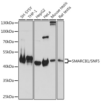 SMARCB1/SNF5 Rabbit pAb