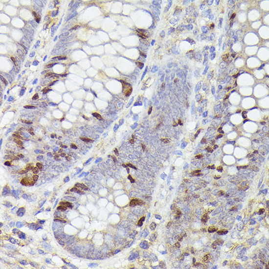 Ki67 Rabbit mAb