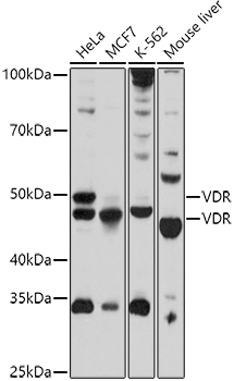 VDR Rabbit pAb