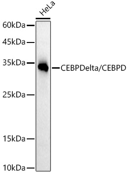 CEBP Delta/CEBPD Rabbit mAb