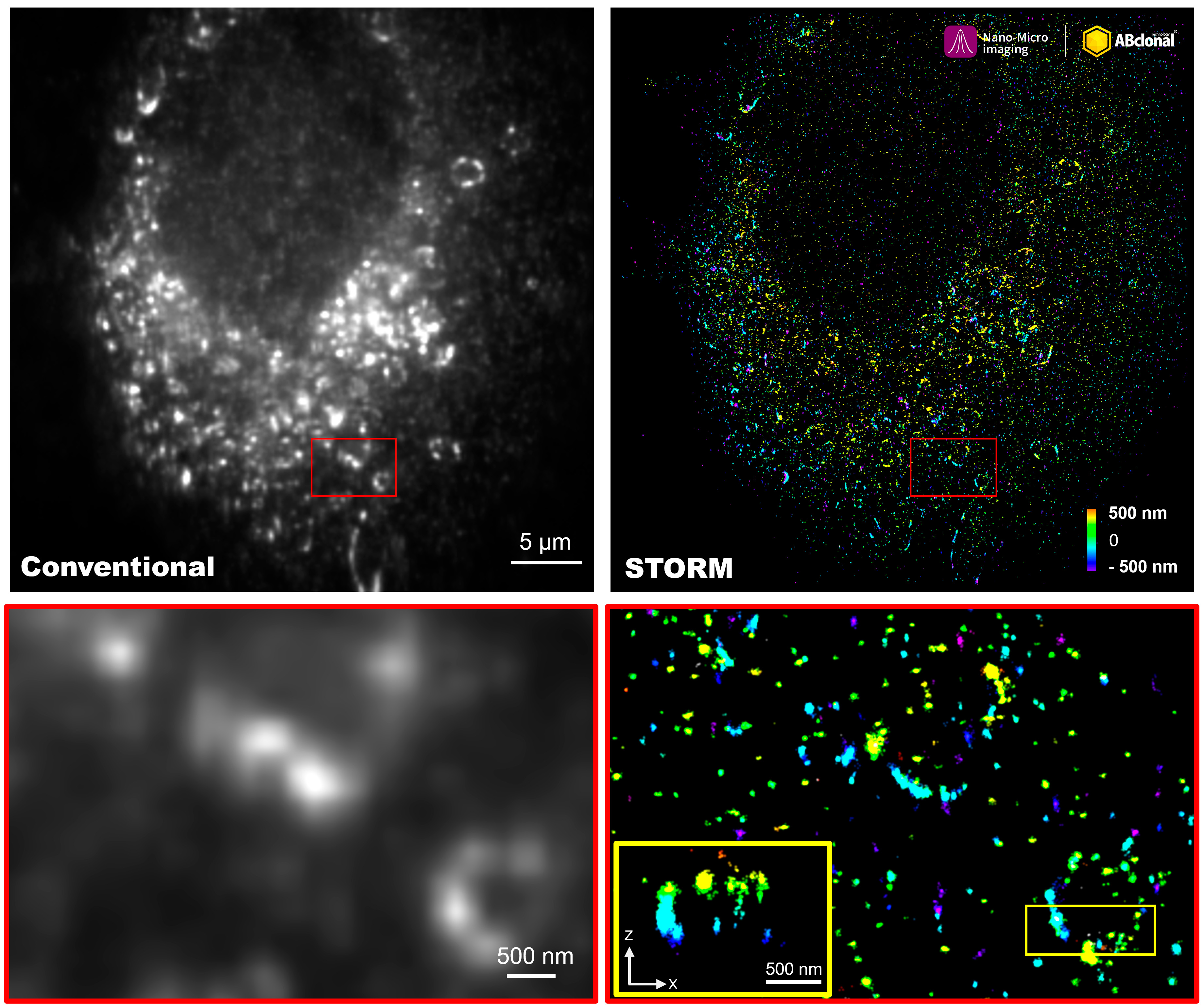 DRP1 Rabbit mAb