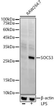 SOCS3 Rabbit mAb