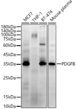 PDGFB Rabbit mAb