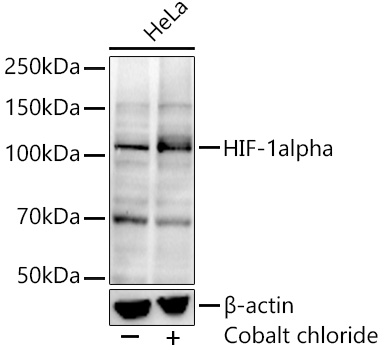 HIF-1alpha Rabbit mAb